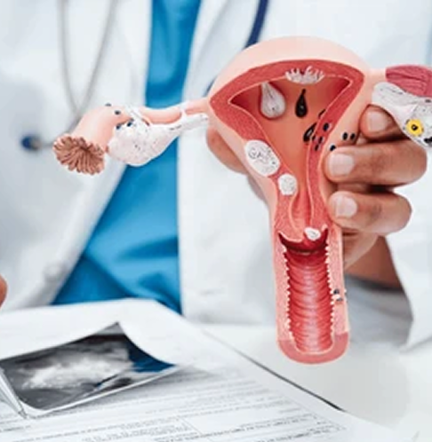 Uterus surgery